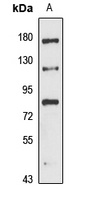 PROX1 Rabbit Polyclonal Antibody