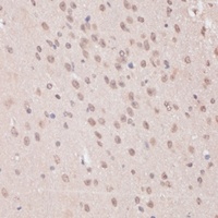Anti-PRPF31 Antibody