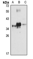 PRPS2 Antibody
