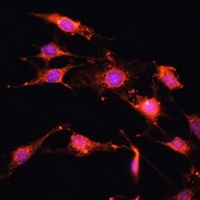 Anti-PRR5 Antibody