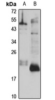 PRRG2 Antibody
