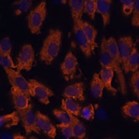 Anti-Periaxin Antibody