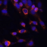 Anti-PSMB7 Antibody