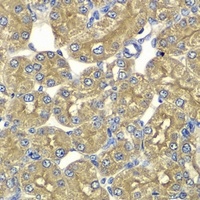 Anti-PSMD5 Antibody