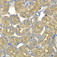 PSMD5 antibody