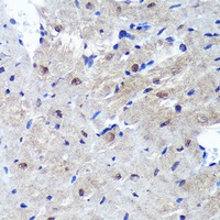 Anti-PSME4 Antibody
