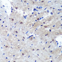 PSME4 antibody