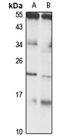 SEEK1 Rabbit Polyclonal Antibody