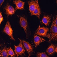 Anti-PTCD1 Antibody