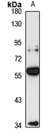PSS-1 Antibody