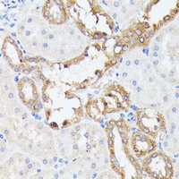 PRL2 antibody