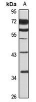 HePTP Rabbit Polyclonal Antibody