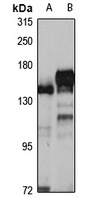 LAR Rabbit Polyclonal Antibody