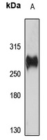 CD148 Rabbit Polyclonal Antibody