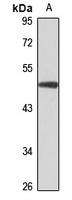 PUS1 Rabbit Polyclonal Antibody