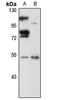 PWP1 Rabbit Polyclonal Antibody