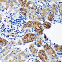 Anti-PYCR2 Antibody