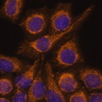 Anti-PYCR2 Antibody
