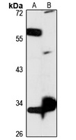 QAPRTase Antibody