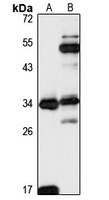 Rab 12 Rabbit Polyclonal Antibody