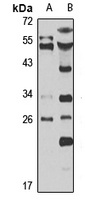 Rab 4A Rabbit Polyclonal Antibody