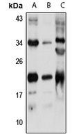 RAB9A Rabbit Polyclonal Antibody