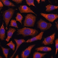 Anti-RABGGTA Antibody
