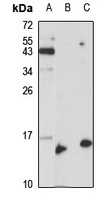 RABIF Antibody