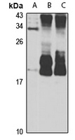RAC3 Rabbit Polyclonal Antibody