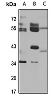 RAR gamma Rabbit Polyclonal Antibody