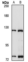RASA1 Rabbit Polyclonal Antibody