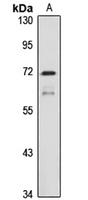 RasGRP2 Rabbit Polyclonal Antibody