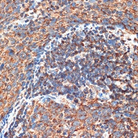 Anti-RB1CC1 Antibody
