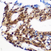 RBM15 antibody