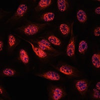 Anti-RBM25 Antibody