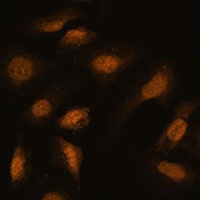 Anti-RBM39 Antibody