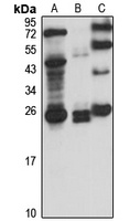 RBPMS Rabbit Polyclonal Antibody