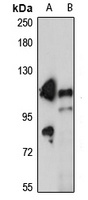 RECK Rabbit Polyclonal Antibody