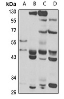 RFPL2 Rabbit Polyclonal Antibody