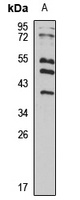 RFPL3 Rabbit Polyclonal Antibody