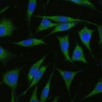Anti-RHBDD1 Antibody