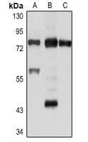 RIPK1 Rabbit Polyclonal Antibody