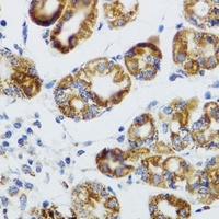 Anti-RIPK4 Antibody