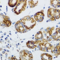 RIPK4 antibody