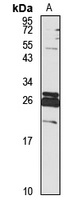Relaxin 1 Rabbit Polyclonal Antibody
