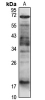 RNASE12 Antibody