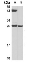 RNase 2 Rabbit Polyclonal Antibody