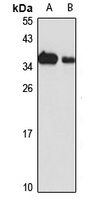 RNase H1 Rabbit Polyclonal Antibody