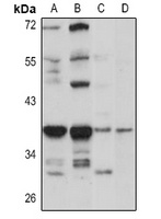 RNase H2B Rabbit Polyclonal Antibody