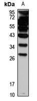 RND3 Rabbit Polyclonal Antibody